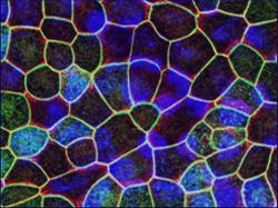 Retinal pigment epithelium derived from induced pluripotent stem cells. Photo credit: Dr. Kapil Bharti.