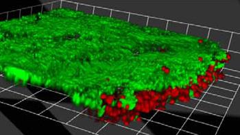 The researchers developed a technique to study live cells in patches of retina, shown here by confocal microscopy. After 2 hours, the vast majority of the cells are alive (green); only a few cells at the perimeter have died (stained red with a dye).