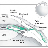 A diagram of the eye with a green arrow showing how fluid normally passes through the space between the iris and the cornea and drains out of the eye back into the bloodstream.
