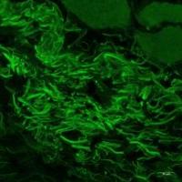 C. mast is a commensal bacterium living on the surface of the eye