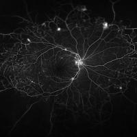 Blood vessels in the retina