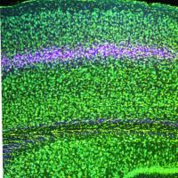 A section of cortex with colorfully labeled layers. Layer 4 stands out in a pinkish hue