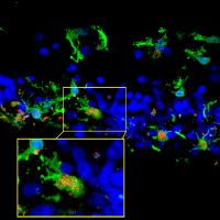 Microglia in retinal sections of a patient with retinitis pigmentosa 