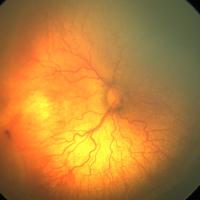 A fundus image
