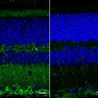 Fluorescent images of mouse retinal layers