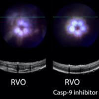 Eye scans showing retinal vein occlusion with and without Casp-9 inhibitor