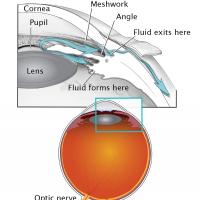 Image shows eye globe, optic nerve, lens, cornea, pupil, meshwork, angle, and where fluid forms and exits the front of the eye.