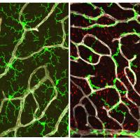 Side-by-side panels showing retinal vessels. Left panel filled with green, right panel much less green.