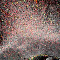 Image of brain cells with "sparks" of red and yellow