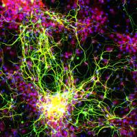 Neurons (green) and their supporting astrocytes (red), created in a petri dish from stem cells.