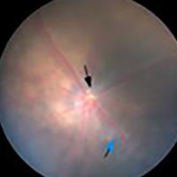 Mouse retina