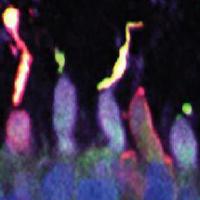 Cone photoreceptors from retinal organoids