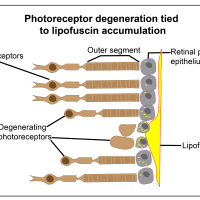 Photoreceptor degeneration tied to lipofuscin accumulation.