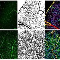 retina blood vessels