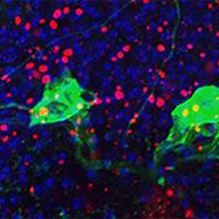 Cells of the fruit fly brain.