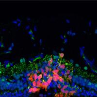 Photoreceptor precursors