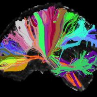 Long distance connections in the brain.