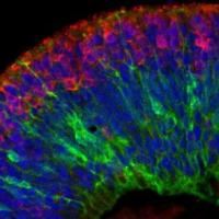 Fluorencent microscope image of retinal organoid colored in red, blue and green