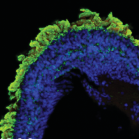 Retinal organoid with green photoreceptor outer segments.