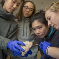Researchers examining brain