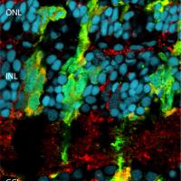 Fluorescently labeled injured zebrafish retina.