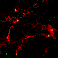 Microscopy image of red fluorescent retinal neurons
