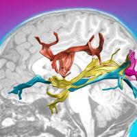 Brain pathways for visual processing