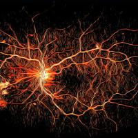Artistic rendering of retinal blood vessels with blood vessel damage.