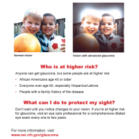 Glaucoma: Vision simulation handout