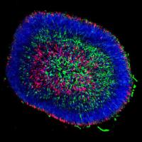 Retinal organoid