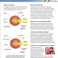  La Miopía (Nearsightedness) thumbnail