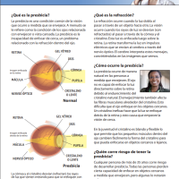 La Presbicia thumbnail