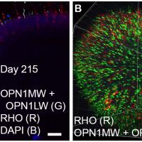 Multiphoton images show the outer segments of cone and rod photoreceptor cells in 215-day retinal organoids. Immunostaining shows a marker for cones (green) and rods (red). The “A” view shows optical sections; “B” is a reconstructed three-dimensional view. 