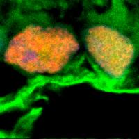 Photo shows microscopy image of exosomes in green surrounding retinal ganglion cells in yellow and orange.