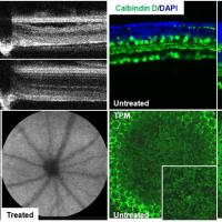 Retinal degeneration in mice