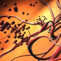 Animation of abnormal blood vessels bleeding into the center of the eye due to proliferative diabetic retinopathy. Photo credit: National Eye Institute. Watch video.