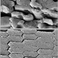 Mice with AQP0 mutations (top) had disorderly fiber cells compared to mice with healthy AQP0.