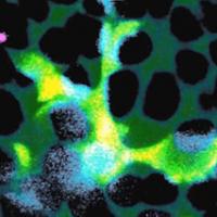 A microglial cell (green) extends spider-like arms to capture and consume rod photoreceptor cells (blue). Credit: Dr. Wai Wong, NEI.