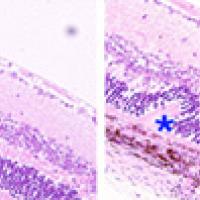 A healthy mouse retina (left) and distinctive folds in a mouse retina damaged by autoimmune uveitis (right). Credit: Wang et al. Nature Medicine, April 2014.