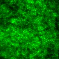 Images show multimodal technique using adaptive optics and angiography to simultaneously see photoreceptors (left), retinal pigment epithelial cells (center), and choriocapillaris in the living human eye.